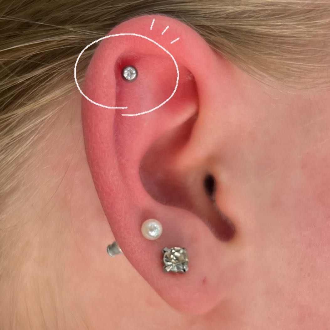 HELIX