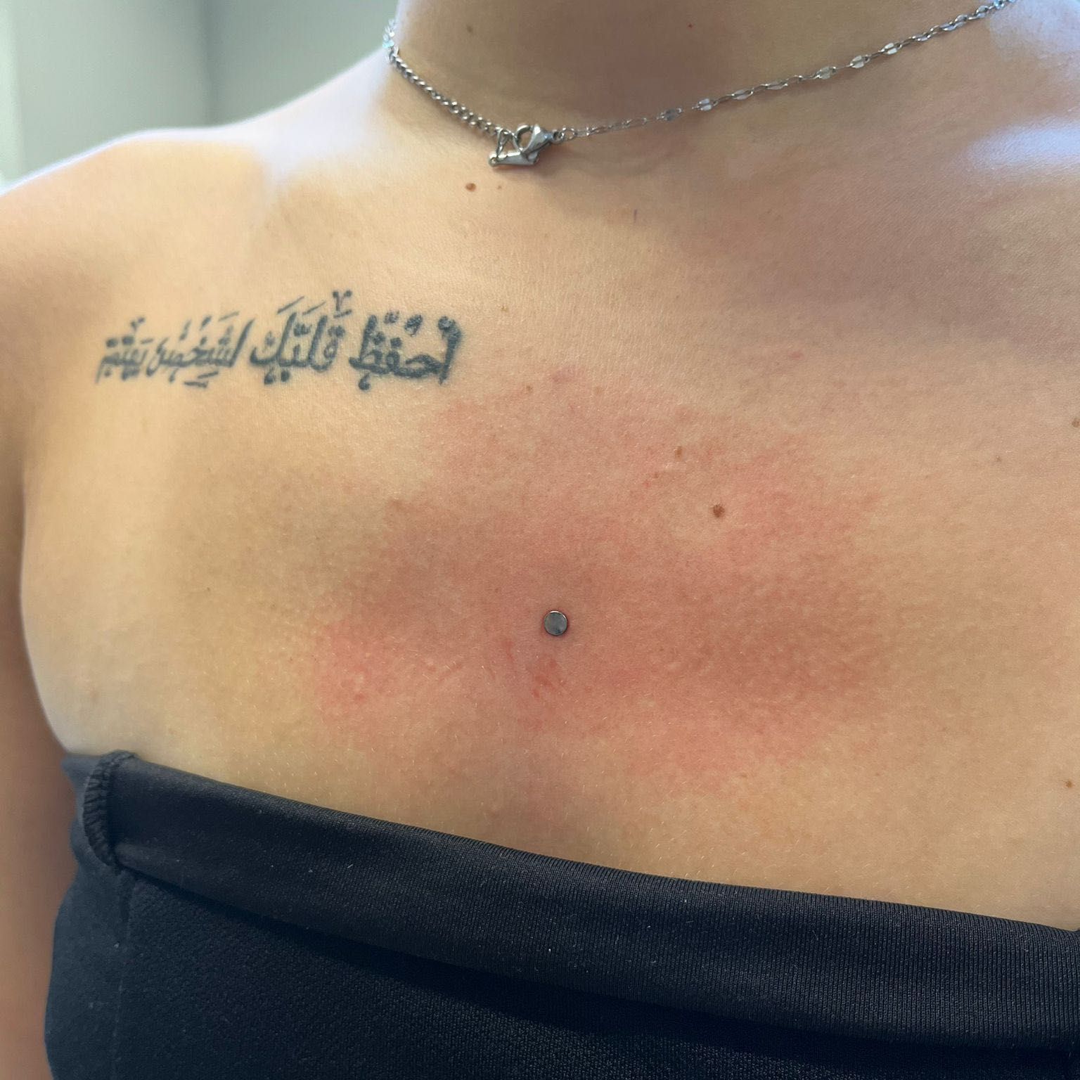 MICRODERMAL