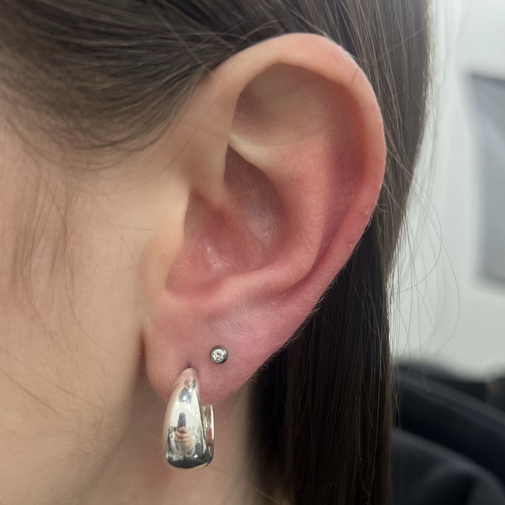 UPPER LOBE