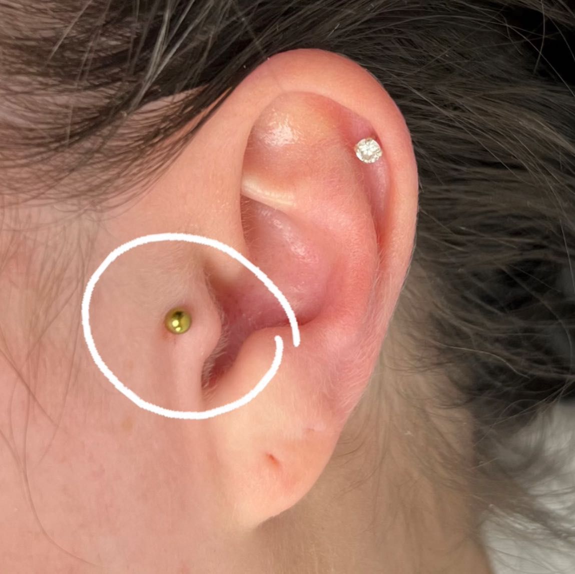 TRAGUS