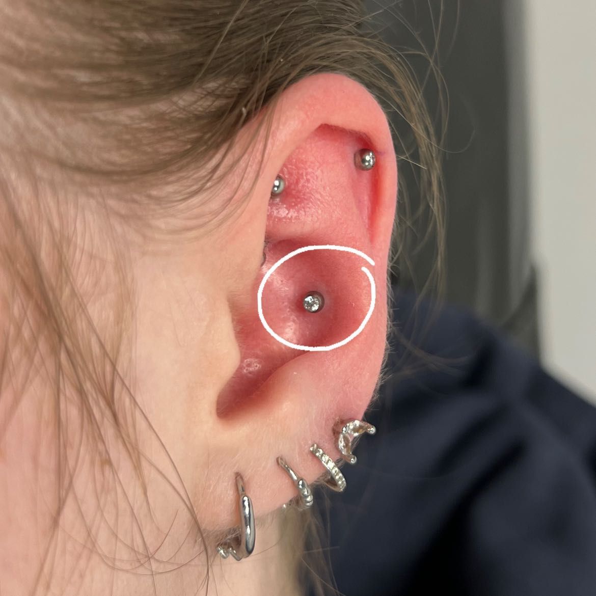 CONCH