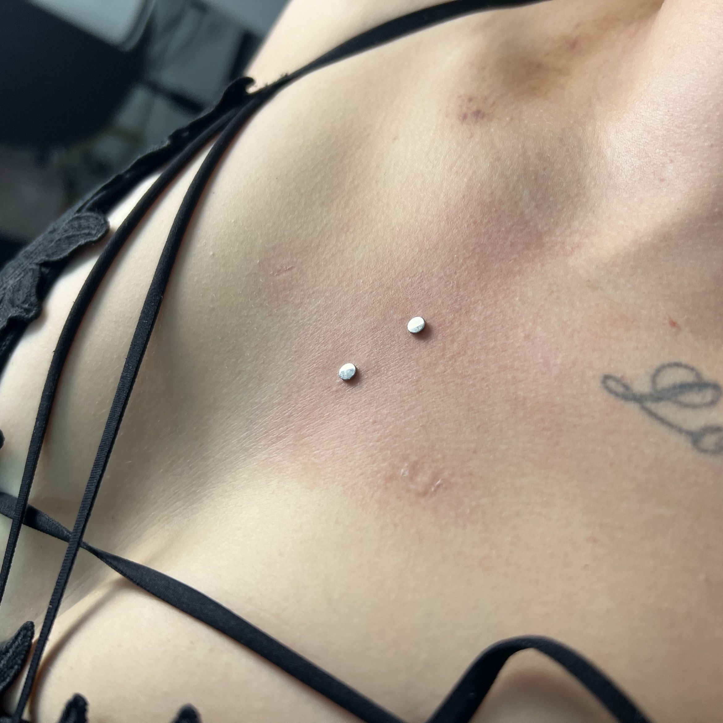 STERNUM